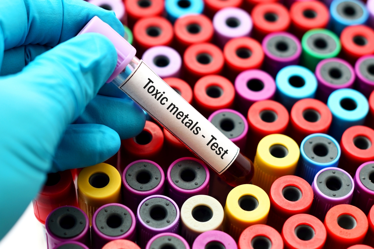 Essential Elements and Toxic Metals Testing 